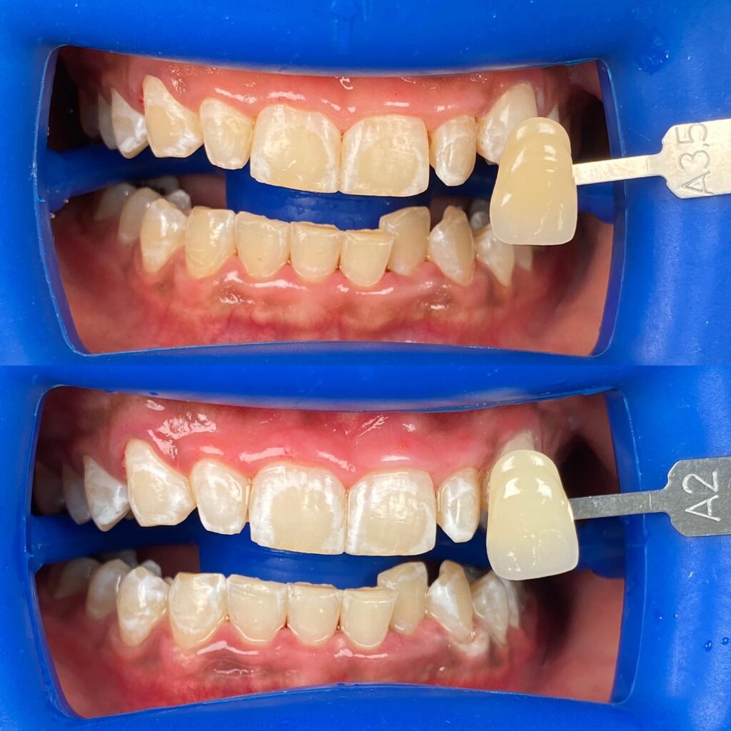 brace dental services